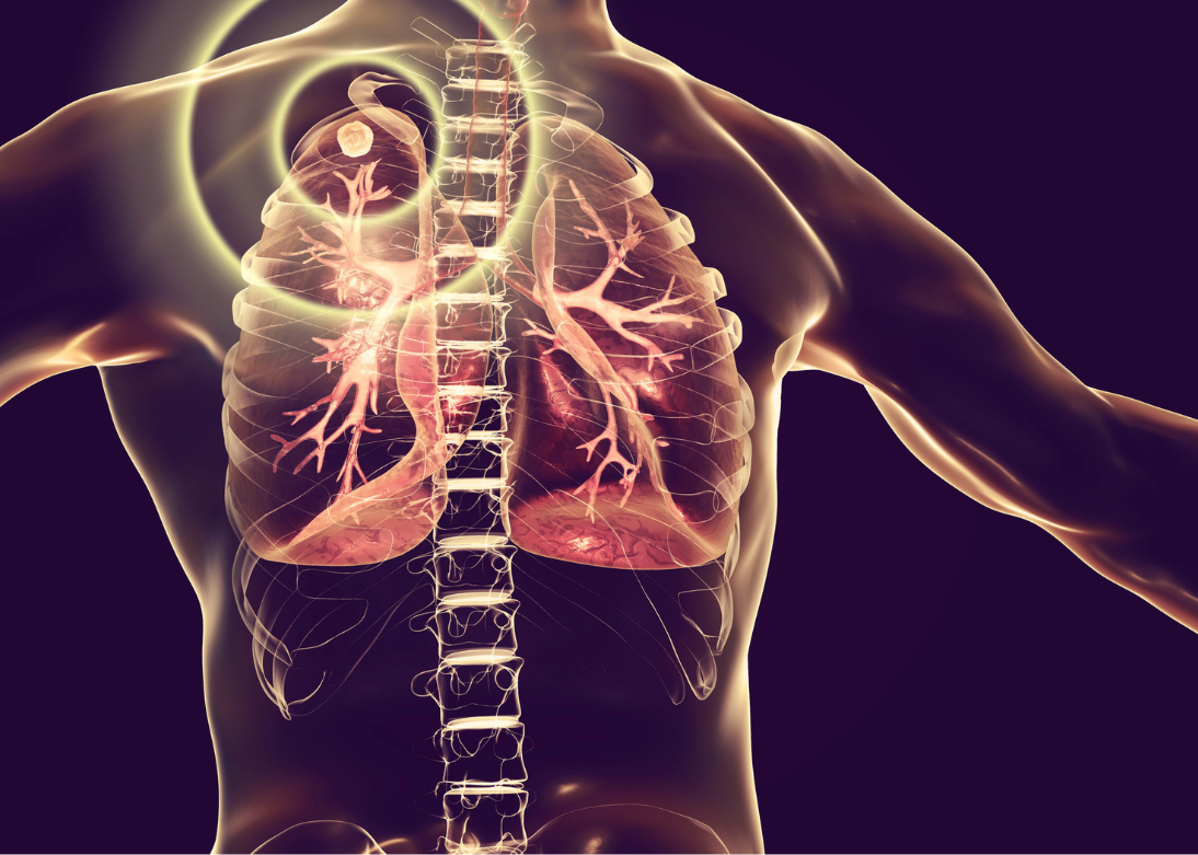 Tuberculosis Specialist